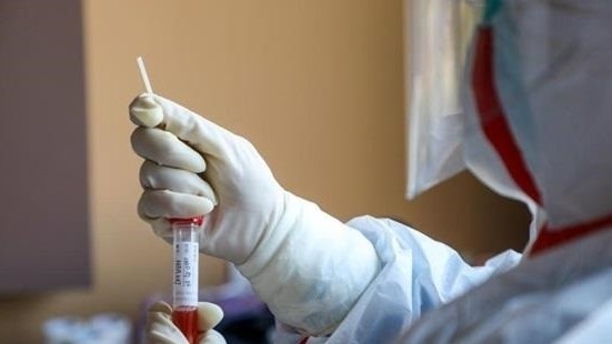 Количество инфицированных COVID-19 в Таджикистане достигло 7 104