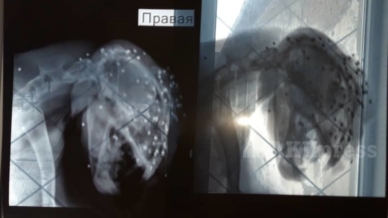 Рентген-снимок головы Жаабарса
